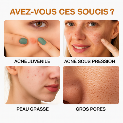 Patchs Anti-Acné ACNEZE™